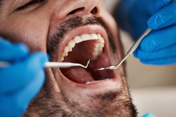 Best Emergency Dental Extractions in Gambier, OH