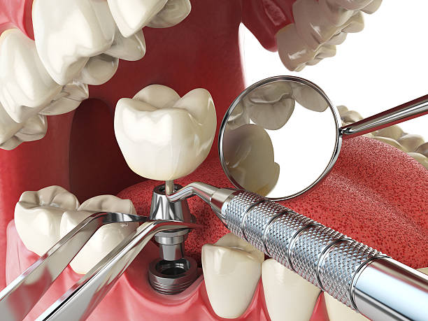 Best Weekend Emergency Dentist in Gambier, OH