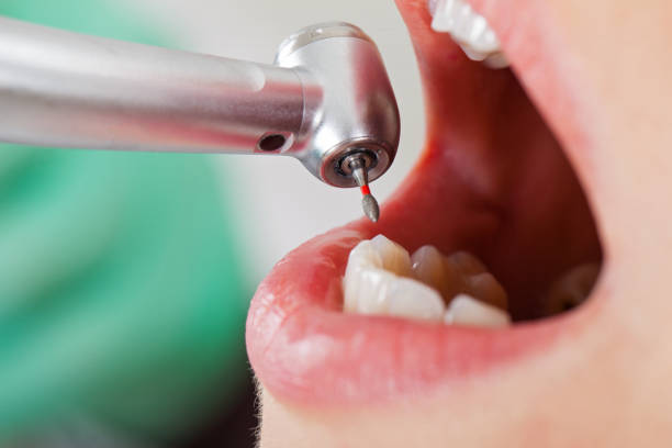 Best Emergency Dental Services for Seniors in Gambier, OH